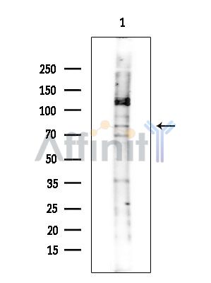 MAP4K5 Antibody - Western blot analysis of extracts from COLO205 cells(heat-shock treatment), using MAP4K5 Antibody at 1/1000 dilution.