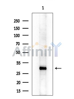 ABHD10 Antibody - Western blot analysis of extracts from EC304 cells(heat-shock treatment), using ABHD10 Antibody at 1/1000 dilution.