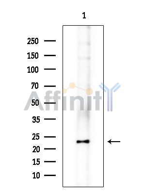DHRS11 Antibody - Western blot analysis of extracts from COLO205 cells(heat-shock treatment), using DHRS11 Antibody at 1/1000 dilution.