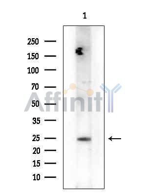 HSD17B12 Antibody - Western blot analysis of extracts from COLO205 cells(heat-shock treatment), using HSD17B12 Antibody at 1/1000 dilution.