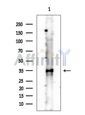 Phospho-TIS11B (Ser92) Antibody - Western blot analysis of extracts from COLO205 cells(heat-shock treatment), using Phospho-TIS11B (Ser92) Antibody at 1/1000 dilution.