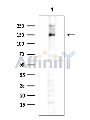 IRS1 Antibody - Western blot analysis of extracts from COLO205 cells(heat-shock treatment), using IRS1 Antibody at 1/1000 dilution.