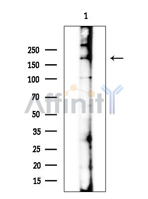 IRS1 Antibody - Western blot analysis of extracts from EC304 cells(heat-shock treatment), using IRS1 Antibody at 1/1000 dilution.