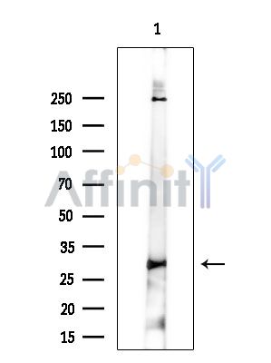 TMS1/ASC Antibody - Western blot analysis of extracts from COLO205 cells(heat-shock treatment), using TMS1/ASC Antibody at 1/1000 dilution.
