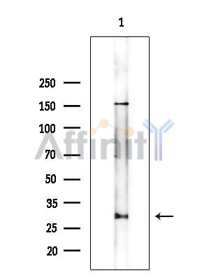 TMS1/ASC Antibody - Western blot analysis of extracts from EC304 cells(heat-shock treatment), using TMS1/ASC Antibody at 1/1000 dilution.
