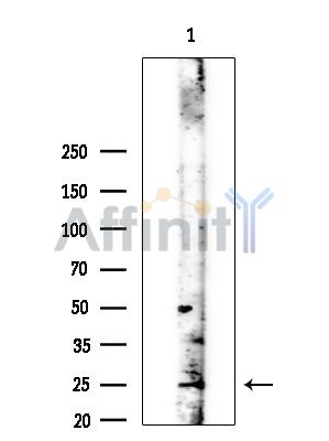 FGF23 Antibody - Western blot analysis of extracts from EC304 cells(heat-shock treatment), using FGF23 Antibody at 1/1000 dilution.
