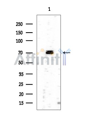 Phospho-IRAK1 (Thr387) Antibody - Western blot analysis of extracts from Rat brain, using Phospho-IRAK1 (Thr387) Antibody at 1/1000 dilution.