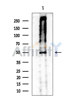 Phospho-MEK1/2 (Ser218+Ser222/Ser222+Ser226) Antibody - Western blot analysis of extracts from COLO205 cells(heat-shock treatment), using Phospho-MEK1/2 (Ser218+Ser222/Ser222+Ser226) Antibody at 1/1000 dilution.