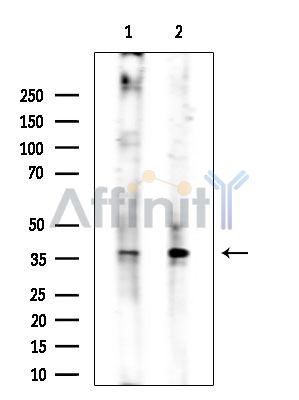 Phospho-CDK1/CDC2 (Thr161) Antibody - Western blot analysis of extracts from various samples, using Phospho-CDK1/CDC2 (Thr161) Antibody at 1/1000 dilution.