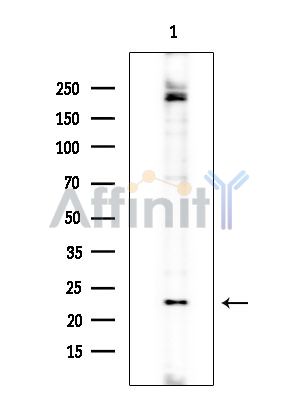 CA150 Antibody - Western blot analysis of extracts from COLO205 cells(heat-shock treatment), using CA150 Antibody at 1/1000 dilution.