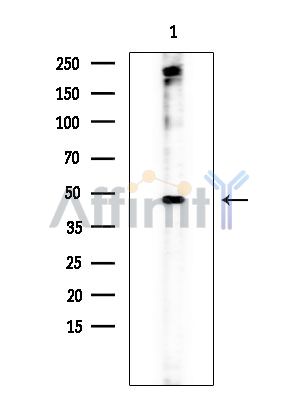 JHD3D Antibody - Western blot analysis of extracts from Rat brain, using JHD3D Antibody at 1/1000 dilution.