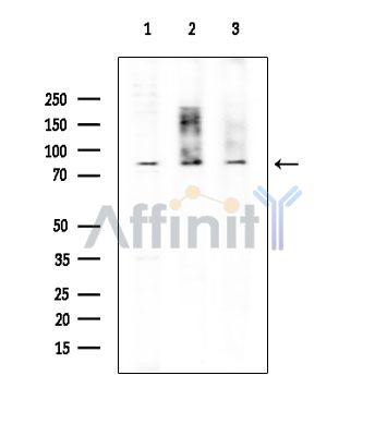 EXO1 Antibody - Western blot analysis of extracts from various samples, using EXO1 Antibody at 1/1000 dilution.
