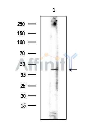KCNK15 Antibody - Western blot analysis of extracts from EC304 cells(heat-shock treatment), using KCNK15 Antibody at 1/1000 dilution.