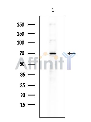RBBP5 Antibody - Western blot analysis of extracts from COLO205 cells(heat-shock treatment), using RBBP5 Antibody at 1/1000 dilution.