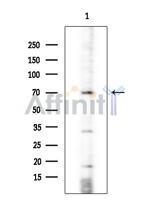 ARHGEF7 Antibody - Western blot analysis of extracts from COLO205 cells(heat-shock treatment), using ARHGEF7 Antibody at 1/1000 dilution.