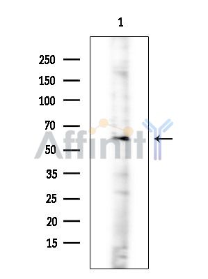 ARHGEF7 Antibody - Western blot analysis of extracts from Mouse testis, using ARHGEF7 Antibody at 1/1000 dilution.