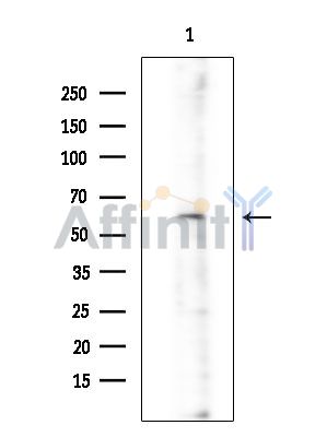 ARHGEF7 Antibody - Western blot analysis of extracts from EC304 cells(heat-shock treatment), using ARHGEF7 Antibody at 1/1000 dilution.