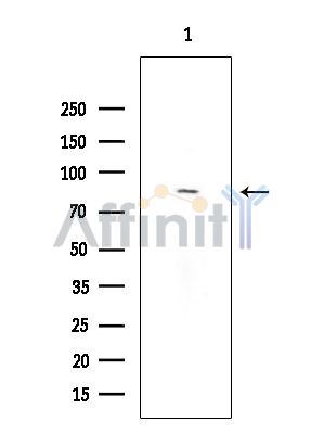 TLK2 Antibody - Western blot analysis of extracts from Rat brain, using TLK2 Antibody at 1/1000 dilution.