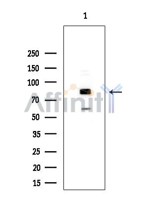 TLK2 Antibody - Western blot analysis of extracts from COLO205 cells(heat-shock treatment), using TLK2 Antibody at 1/1000 dilution.