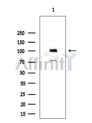 TLK2 Antibody - Western blot analysis of extracts from Mouse testis, using TLK2 Antibody at 1/1000 dilution.
