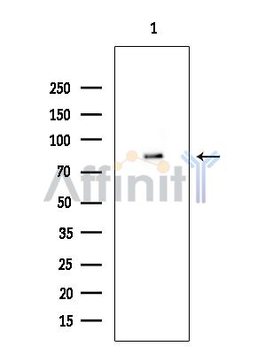 TLK2 Antibody - Western blot analysis of extracts from EC304 cells(heat-shock treatment), using TLK2 Antibody at 1/1000 dilution.