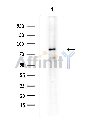 ZNF280C Antibody - Western blot analysis of extracts from EC304 cells(heat-shock treatment), using ZNF280C Antibody at 1/1000 dilution.