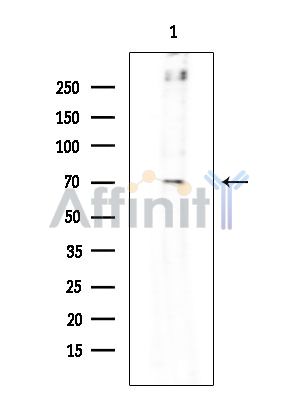SYTL4 Antibody - Western blot analysis of extracts from EC304 cells(heat-shock treatment), using SYTL4 Antibody at 1/1000 dilution.