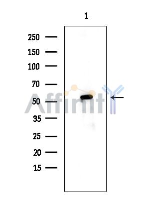 TIGD3 Antibody - Western blot analysis of extracts from EC304 cells(heat-shock treatment), using TIGD3 Antibody at 1/1000 dilution.