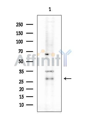 Kallikrein 7 Antibody - Western blot analysis of extracts from COLO205 cells(heat-shock treatment), using Kallikrein 7 Antibody at 1/1000 dilution.