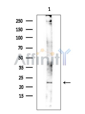 RAB24 Antibody - Western blot analysis of extracts from EC304 cells(heat-shock treatment), using RAB24 Antibody at 1/1000 dilution.