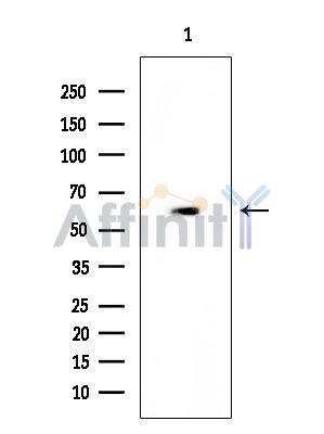 Desmin Antibody - Western blot analysis of extracts from COLO205 cells(heat-shock treatment), using Desmin Antibody at 1/1000 dilution.
