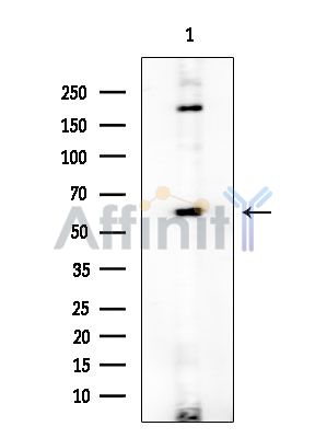 Desmin Antibody - Western blot analysis of extracts from Mouse testis, using Desmin Antibody at 1/1000 dilution.