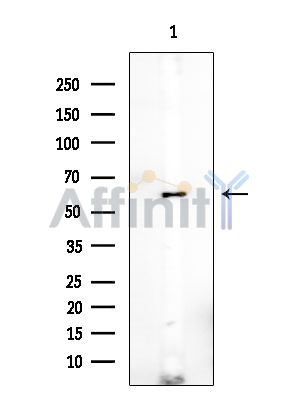 Desmin Antibody - Western blot analysis of extracts from EC304 cells(heat-shock treatment), using Desmin Antibody at 1/1000 dilution.