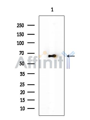 HSP60 Antibody - Western blot analysis of extracts from EC304 cells(heat-shock treatment), using HSP60 Antibody at 1/1000 dilution.