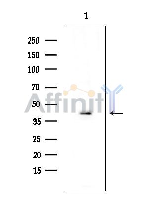 Cytokeratin 7 Antibody - Western blot analysis of extracts from COLO205 cells(heat-shock treatment), using Cytokeratin 7 Antibody at 1/1000 dilution.
