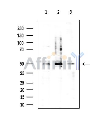 Vimentin Antibody - Western blot analysis of extracts from various samples, using Vimentin Antibody at 1/1000 dilution.