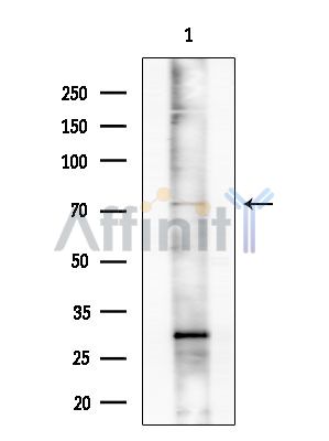 hnRNP M Antibody - Western blot analysis of extracts from COLO205 cells(heat-shock treatment), using hnRNP M Antibody at 1/1000 dilution.