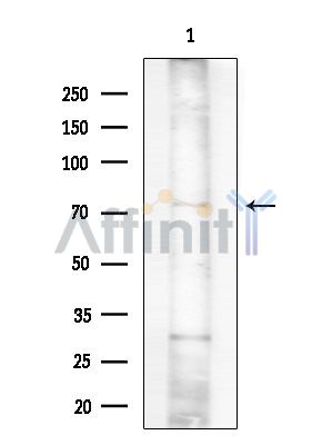 hnRNP M Antibody - Western blot analysis of extracts from EC304 cells(heat-shock treatment), using hnRNP M Antibody at 1/1000 dilution.