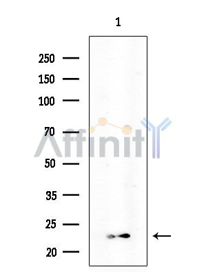 Claudin 11 Antibody - Western blot analysis of extracts from COLO205 cells(heat-shock treatment), using Claudin 11 Antibody at 1/1000 dilution.