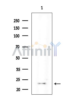 Claudin 11 Antibody - Western blot analysis of extracts from EC304 cells(heat-shock treatment), using Claudin 11 Antibody at 1/1000 dilution.