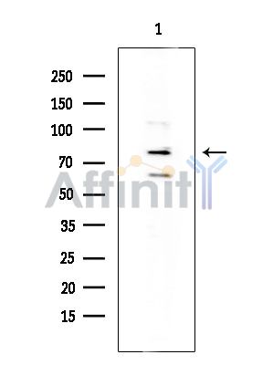 FOXP1 Antibody - Western blot analysis of extracts from Mouse testis, using FOXP1 Antibody at 1/1000 dilution.
