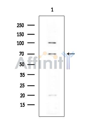 FOXP1 Antibody - Western blot analysis of extracts from EC304 cells(heat-shock treatment), using FOXP1 Antibody at 1/1000 dilution.
