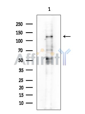 PERK Antibody - Western blot analysis of extracts from COLO205 cells(heat-shock treatment), using PERK Antibody at 1/1000 dilution.