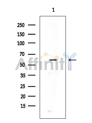 Phospho-DRP1 (Ser616) Antibody - Western blot analysis of extracts from EC304 cells(heat-shock treatment), using Phospho-DRP1 (Ser616) Antibody at 1/1000 dilution.