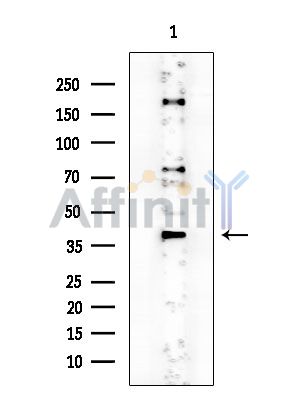 PKR2 Antibody - Western blot analysis of extracts from COLO205 cells(heat-shock treatment), using PKR2 Antibody at 1/1000 dilution.