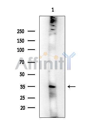 GPCR TGR5 Antibody - Western blot analysis of extracts from Rat liver, using GPCR TGR5 Antibody at 1/1000 dilution.