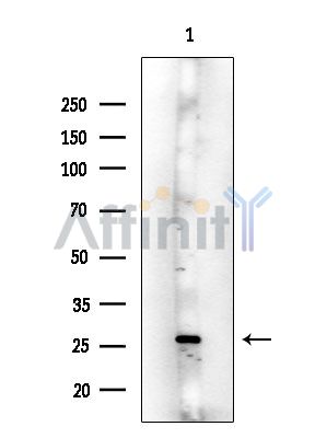 GPCR TGR5 Antibody - Western blot analysis of extracts from Rat spleen, using GPCR TGR5 Antibody at 1/1000 dilution.