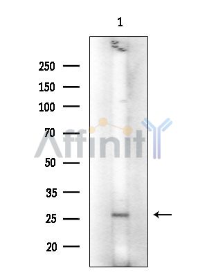GPCR TGR5 Antibody - Western blot analysis of extracts from Rat muscle, using GPCR TGR5 Antibody at 1/1000 dilution.