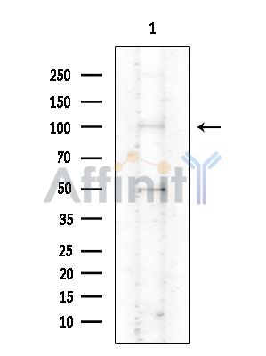 ATP12A Antibody - Western blot analysis of extracts from COLO205 cells(heat-shock treatment), using ATP12A Antibody at 1/1000 dilution.