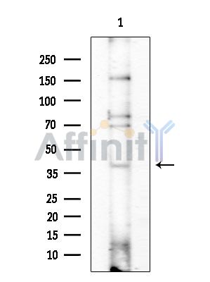 CCNY Antibody - Western blot analysis of extracts from COLO205 cells(heat-shock treatment), using CCNY Antibody at 1/1000 dilution.